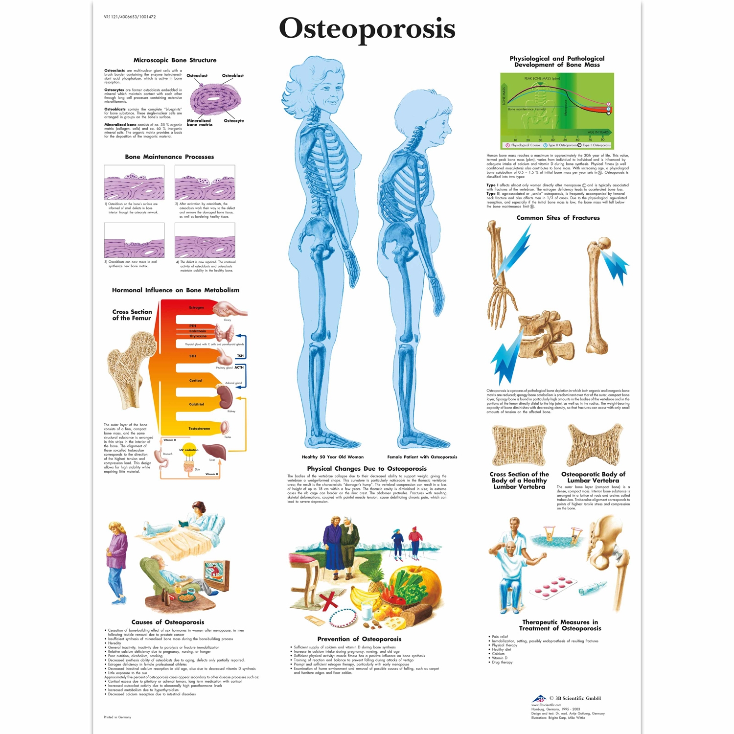 Wandplaat geplastificeerd Osteoporosis - 50 x 67 cm