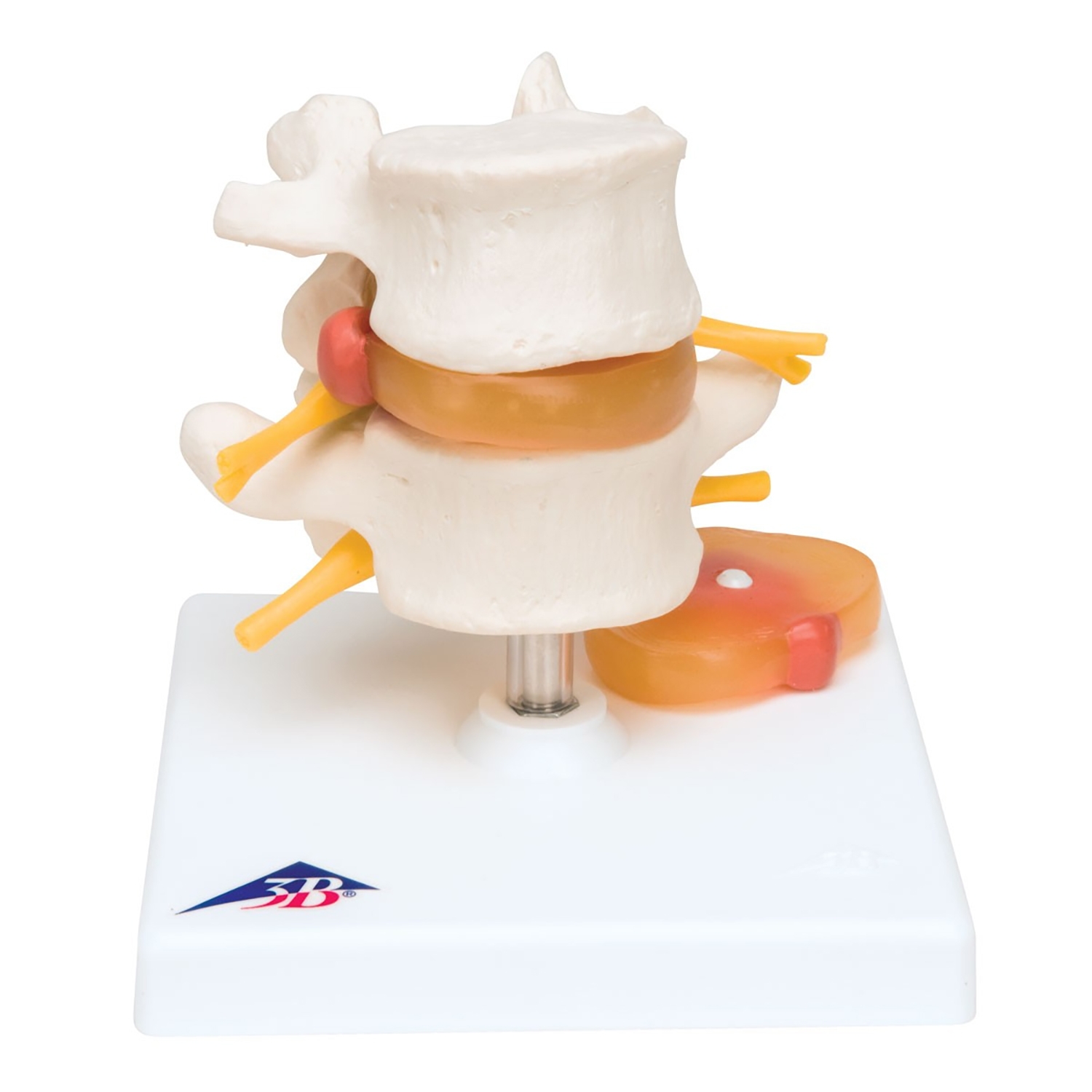 Lumbale set + 2-hernia's
